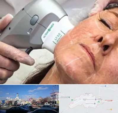 آموزش هایفوتراپی در ماهدشت کرج 