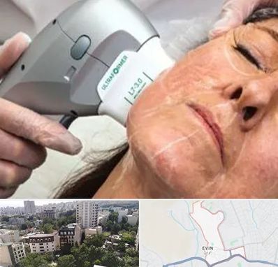 آموزش هایفوتراپی در اوین