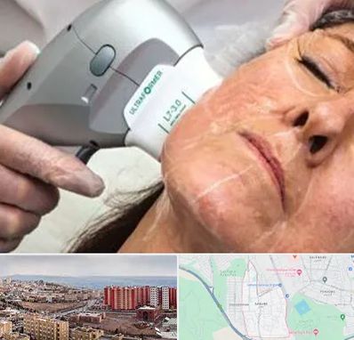 آموزش هایفوتراپی در سهند تبریز