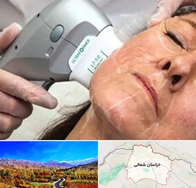 آموزش هایفوتراپی در خراسان شمالی