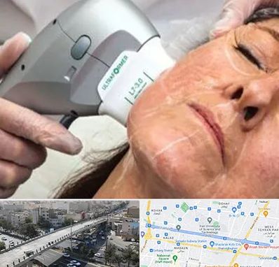 آموزش هایفوتراپی در فرجام 