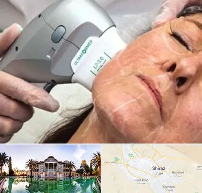 آموزش هایفوتراپی در شیراز