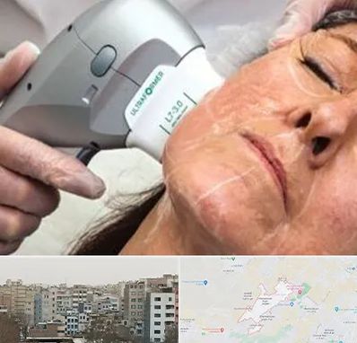 آموزش هایفوتراپی در محمد شهر کرج 