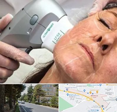 آموزش هایفوتراپی در مهرویلا کرج 