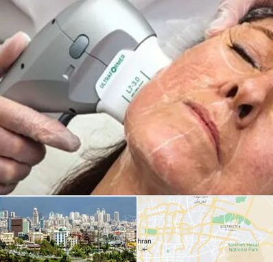 آموزش هایفوتراپی در شرق تهران 