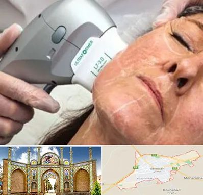 آموزش هایفوتراپی در سمنان