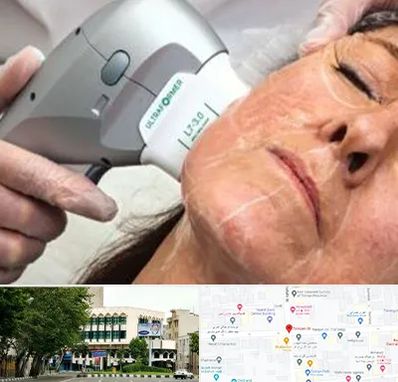 آموزش هایفوتراپی در طالقانی 