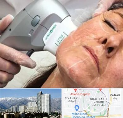 آموزش هایفوتراپی در شهرک غرب