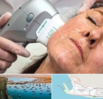 آموزش هایفوتراپی در چابهار