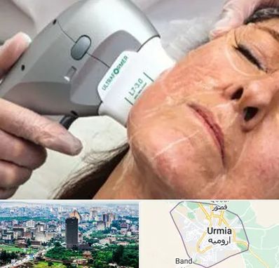 آموزش هایفوتراپی در ارومیه