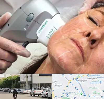 آموزش هایفوتراپی در قدوسی شرقی شیراز 