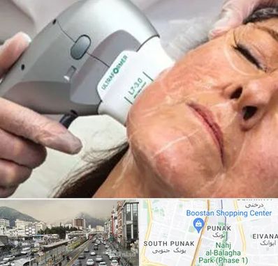 آموزش هایفوتراپی در پونک 