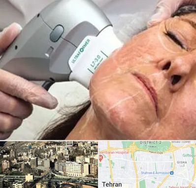 آموزش هایفوتراپی در مرزداران 