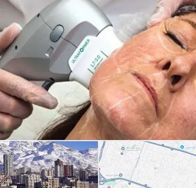 آموزش هایفوتراپی در ازگل