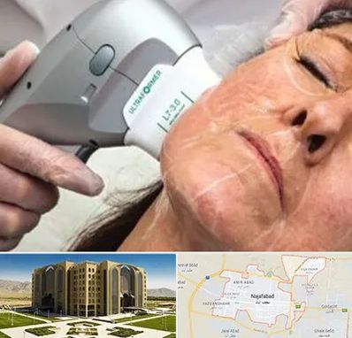 آموزش هایفوتراپی در نجف آباد