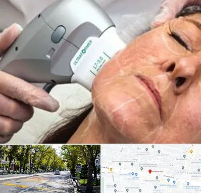 آموزش هایفوتراپی در میرداماد 