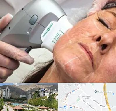 آموزش هایفوتراپی در شهر زیبا 