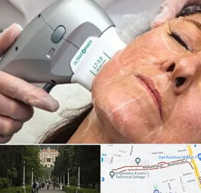 آموزش هایفوتراپی در بلوار معلم رشت 