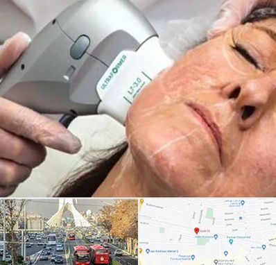 آموزش هایفوتراپی در خیابان آزادی 