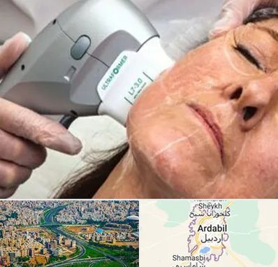 آموزش هایفوتراپی در اردبیل