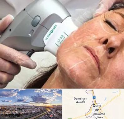 آموزش هایفوتراپی در قم