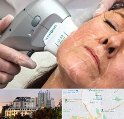 آموزش هایفوتراپی در فرشته 