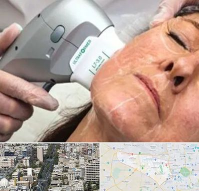 آموزش هایفوتراپی در منطقه 18 تهران 