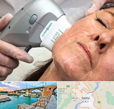 آموزش هایفوتراپی در دزفول