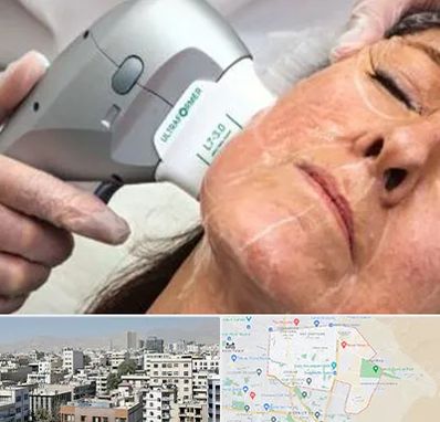 آموزش هایفوتراپی در منطقه 14 تهران 