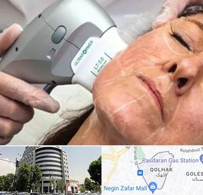 آموزش هایفوتراپی در قلهک 