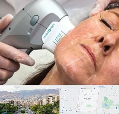 آموزش هایفوتراپی در خانی آباد 