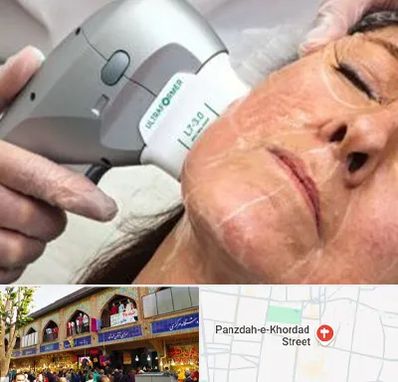 آموزش هایفوتراپی در 15 خرداد