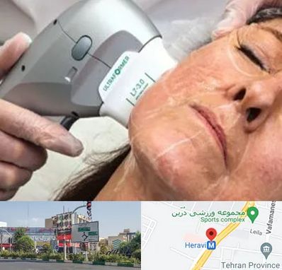 آموزش هایفوتراپی در هروی 