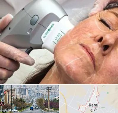 آموزش هایفوتراپی در گوهردشت کرج 