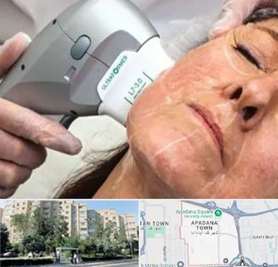 آموزش هایفوتراپی در آپادانا