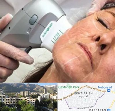 آموزش هایفوتراپی در اختیاریه 