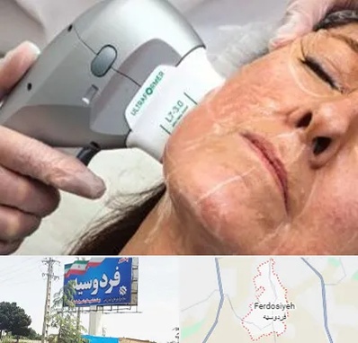 آموزش هایفوتراپی در فردوسیه شهریار