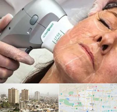 آموزش هایفوتراپی در منطقه 5 تهران 