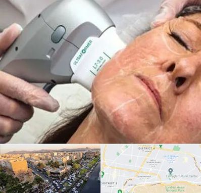 آموزش هایفوتراپی در تهرانپارس 