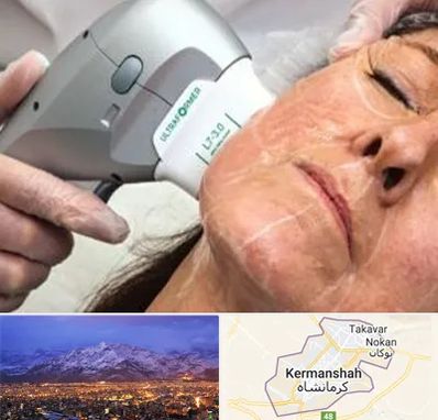 آموزش هایفوتراپی در کرمانشاه