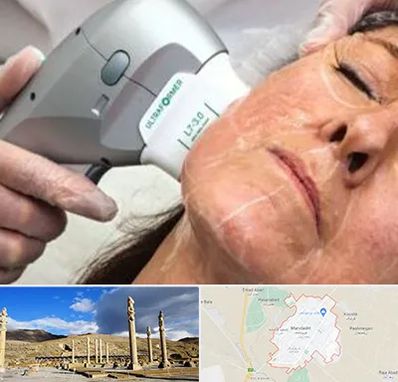 آموزش هایفوتراپی در مرودشت