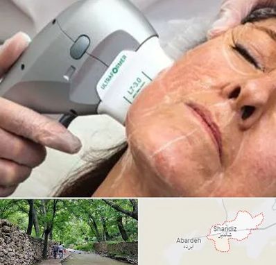 آموزش هایفوتراپی در شاندیز مشهد