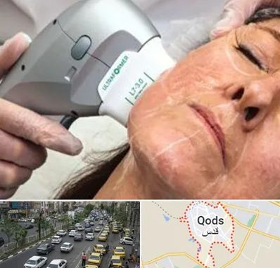 آموزش هایفوتراپی در شهر قدس