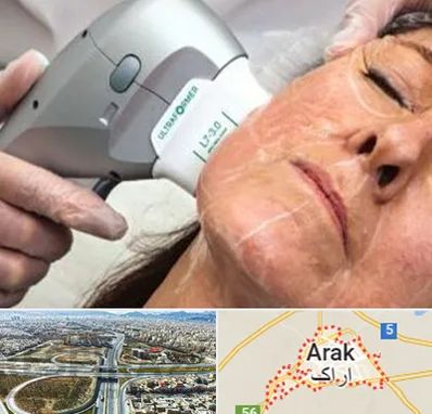 آموزش هایفوتراپی در اراک