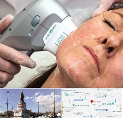 آموزش هایفوتراپی در کارگر جنوبی 