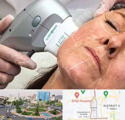 آموزش هایفوتراپی در ونک 