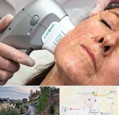 آموزش هایفوتراپی در باغستان کرج 