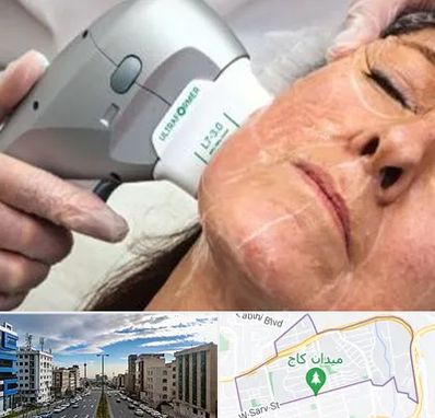 آموزش هایفوتراپی در سعادت آباد 