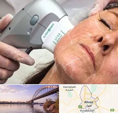 آموزش هایفوتراپی در اهواز