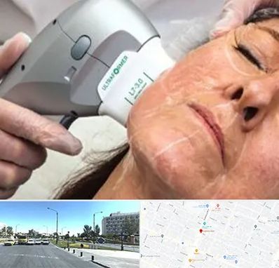 آموزش هایفوتراپی در بلوار کلاهدوز مشهد 